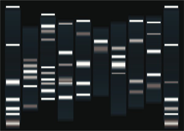 可视化凝胶中的每个条带代表一组大小相同的DNA片段。